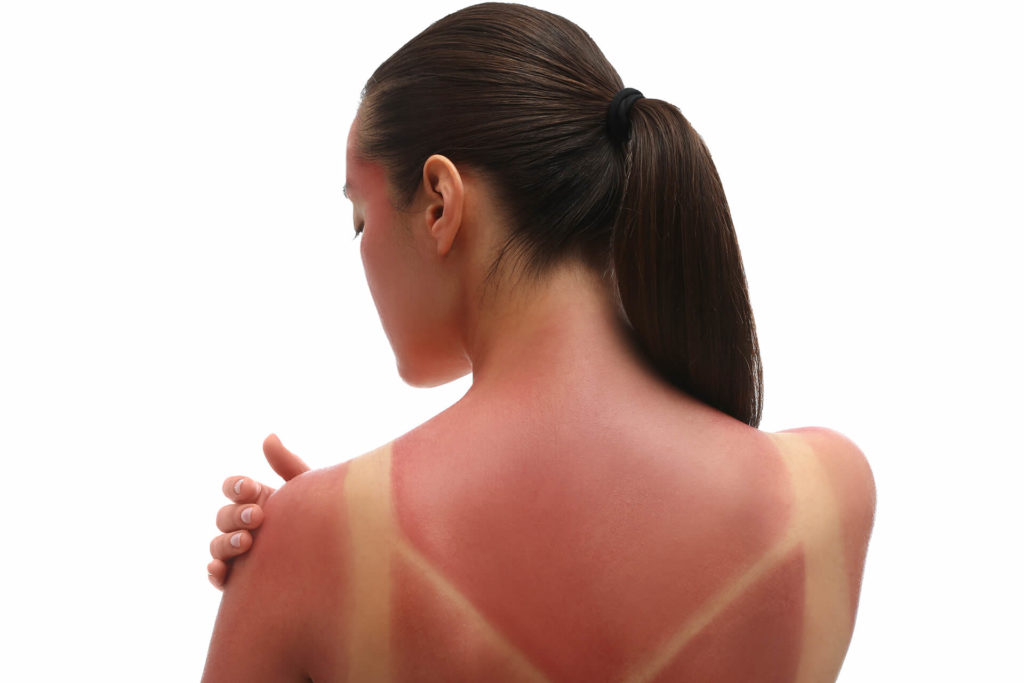 Skin-First-Aid-Featured-CBDBotanicalTherapy